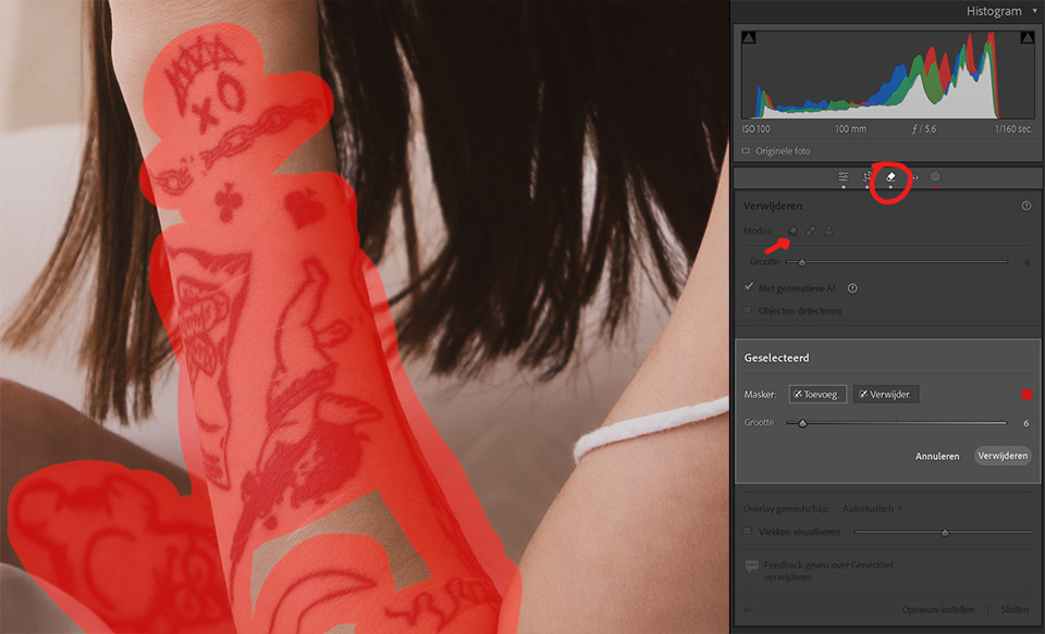 Remove tattoo Remove tattoo