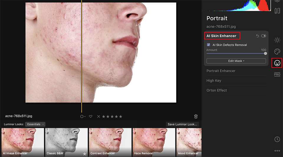 AI skin enhancer acne AI skin enhancer acne